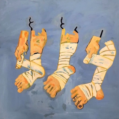Pieds jambes blessées. jpg Pieds jambes blessées. jpg